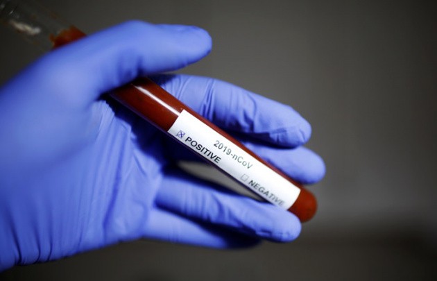 В Узбекистане инфицированных  больных коронавирусом превысило более 8000