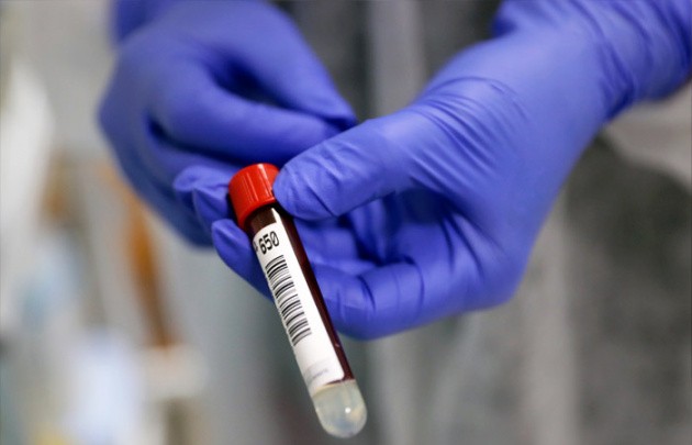 В Узбекистане общее число заболевших коронавирусом приблизилось к 10 000